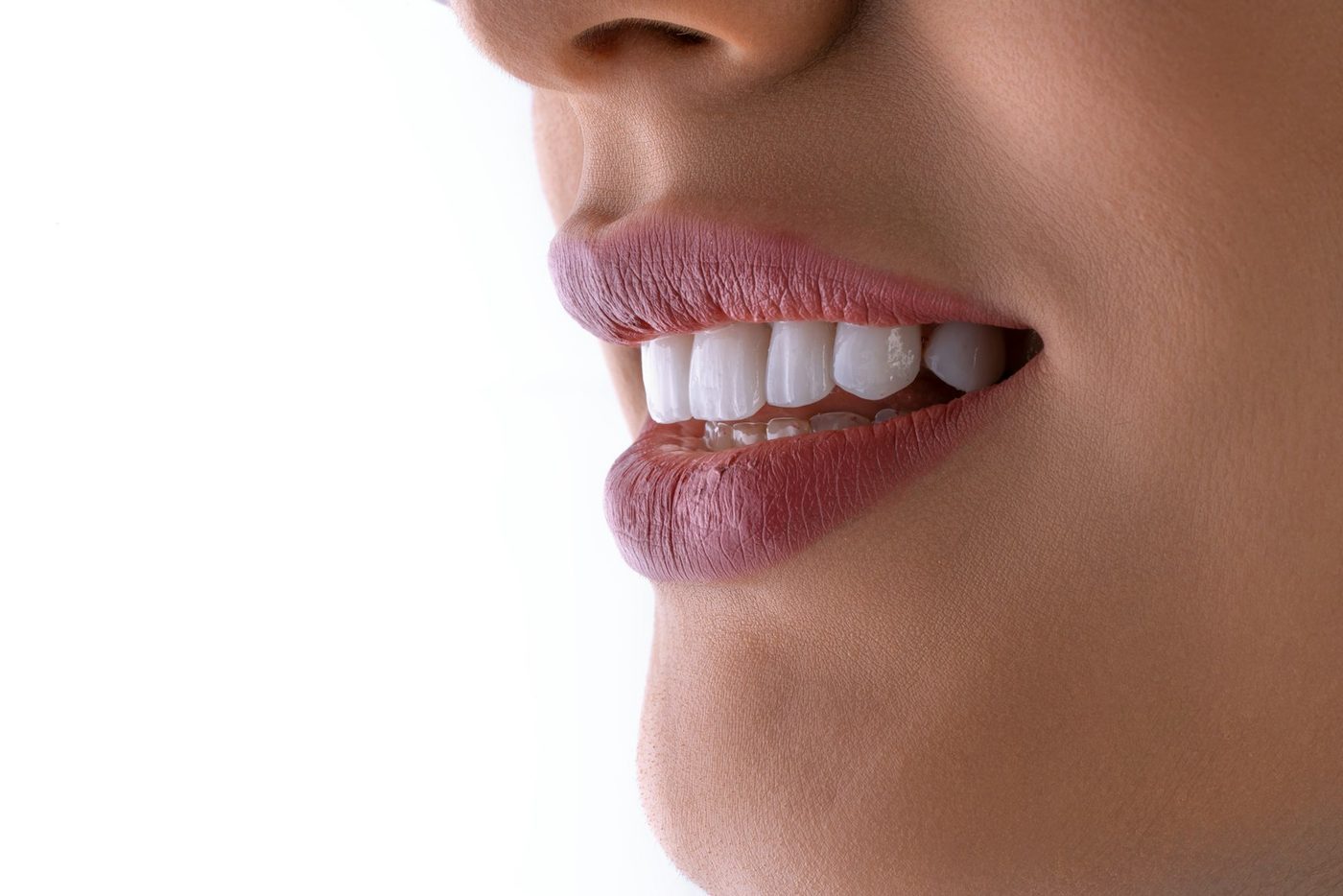 Close-up of a bright, white smile